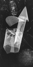 radiograph-5-500